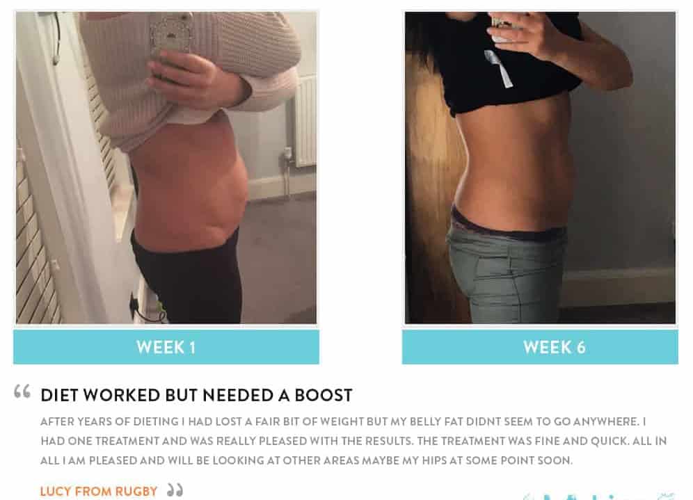 Before and After Dieting Bradford