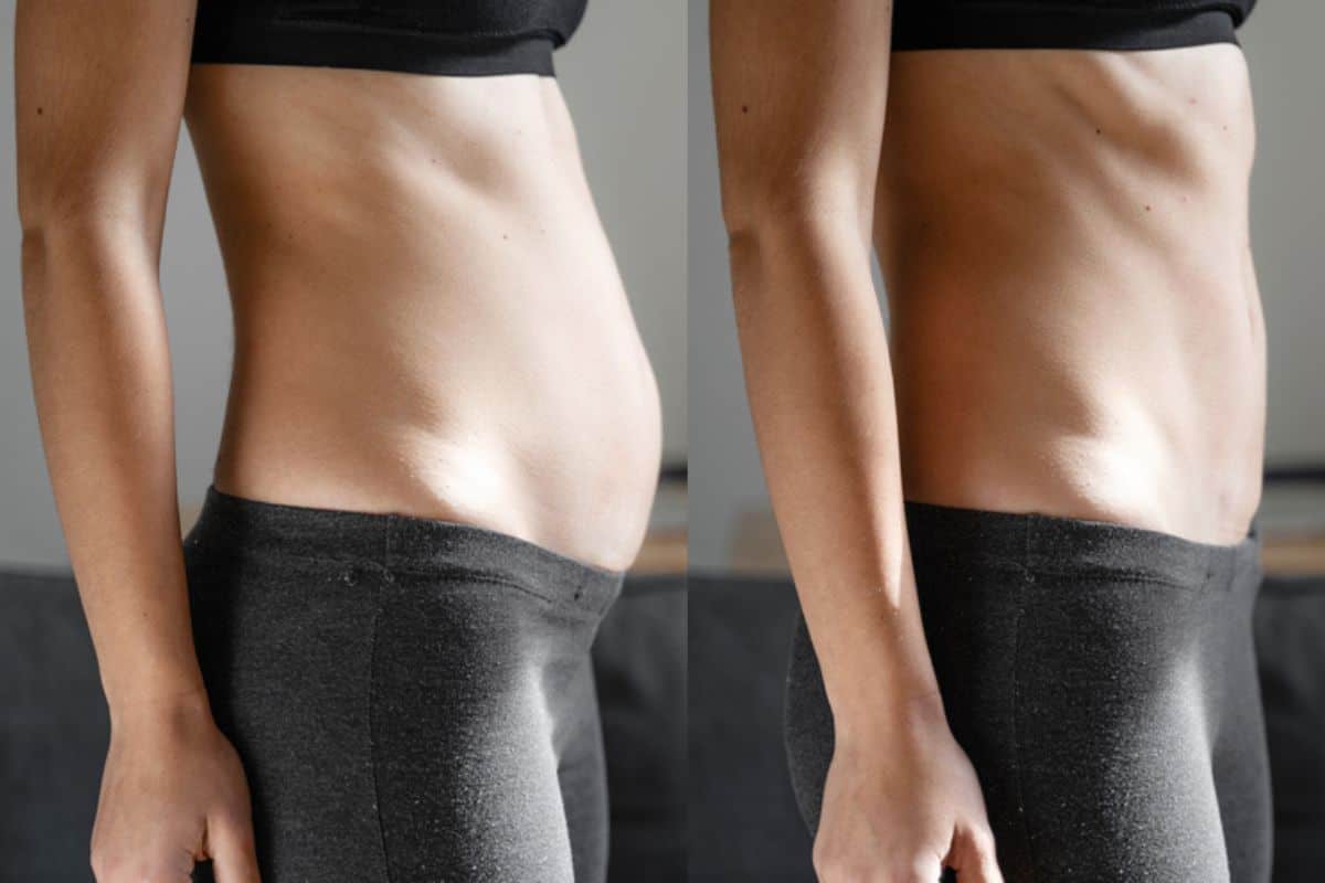Post-Pregnancy: What Happens to Your Abdominal Muscles After Birth Bradford