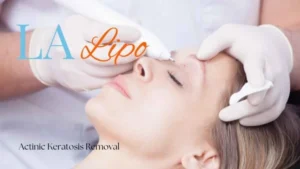 Woman receiving Actinic Keratosis Removal Treatment Bradford