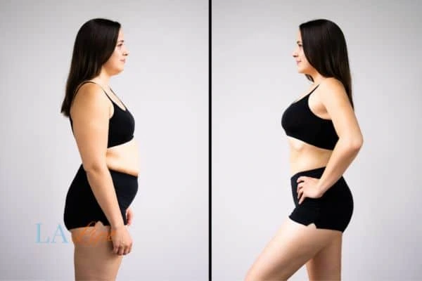 LA-EMS Body Sculpting Bradford results before and after of womans results on body toning.