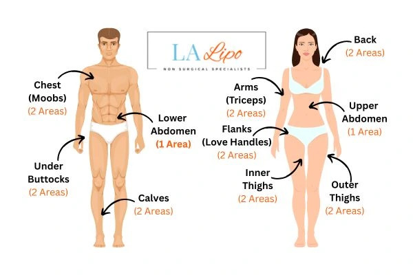 LA LIPO Cryolipolysis Areas Bradford