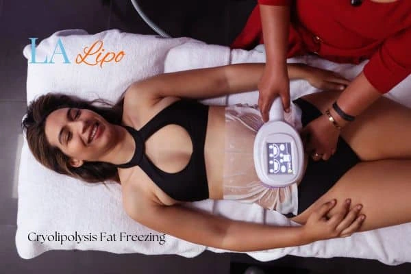 woman getting cryolipolysis Bradford